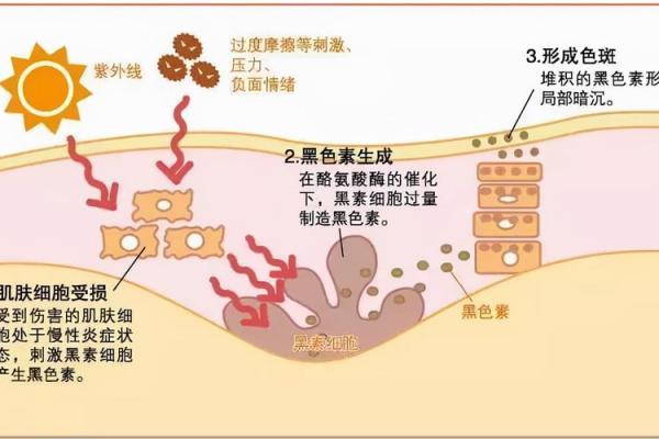 眉间八字纹的形成原因与去除方法解析 眉间八字纹的形成原因与去除方法解析