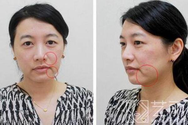 嘴角八字纹揭示了什么样的人生轨迹?揭秘面相中的重要线索 嘴角八字纹揭示了什么样的人生轨迹?揭秘面相中的重要线索