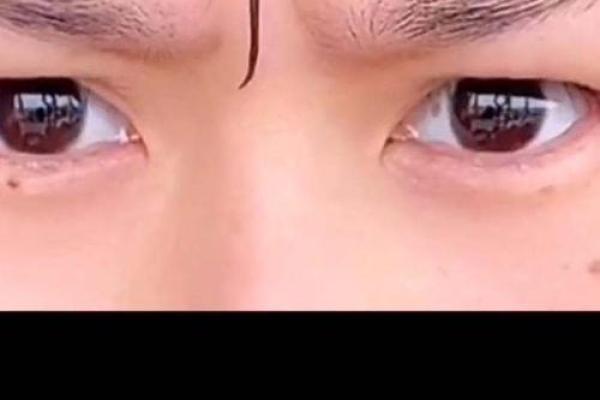 脸部八字纹不再烦恼,快速消除的方法大公开 脸部八字纹不再烦恼,快速消除的方法大公开